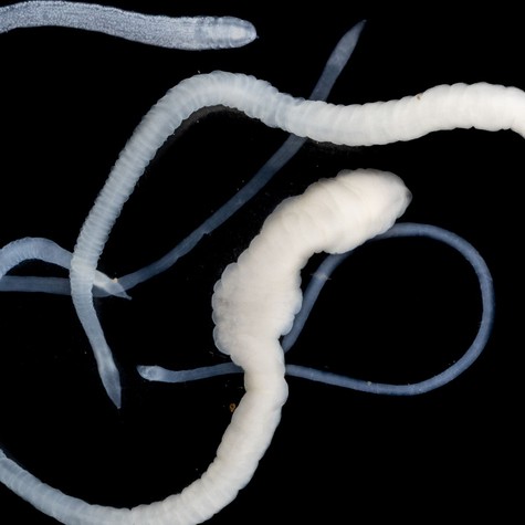 Ezek a tünetek jelezhetik azt, hogy galandféreg él a szervezetében című cikk nyitóképe