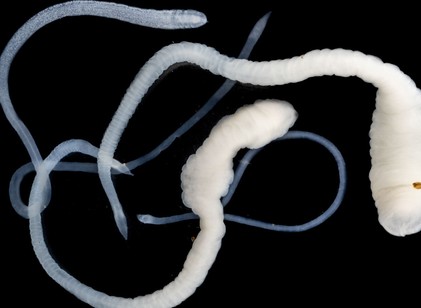 Ezek a tünetek jelezhetik azt, hogy galandféreg él a szervezetében című cikk nyitóképe