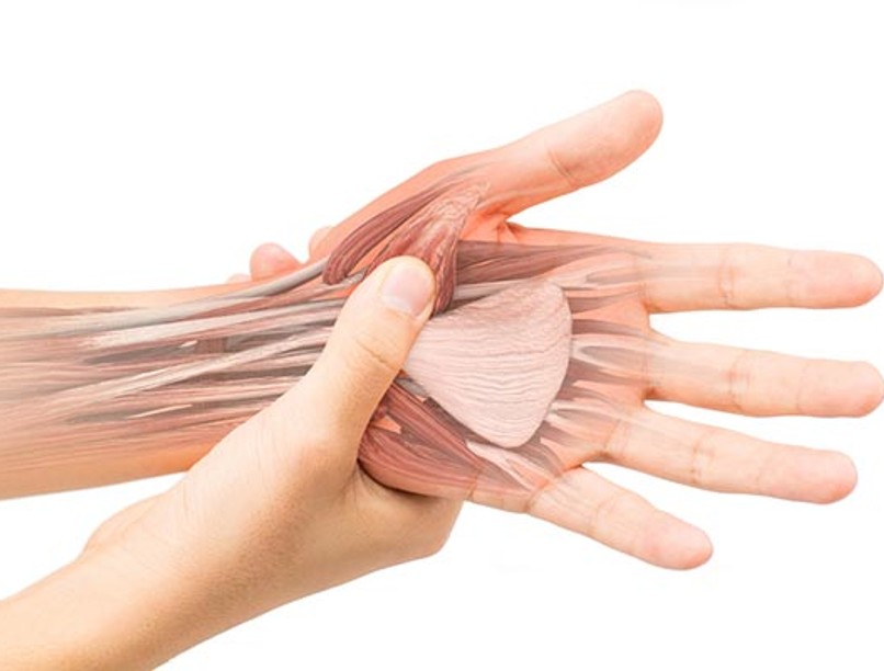 Az inhüvelygyulladás a túlterhelés egyik következménye