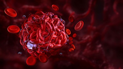 Mire utalnak a vérzések? című cikk nyitóképe