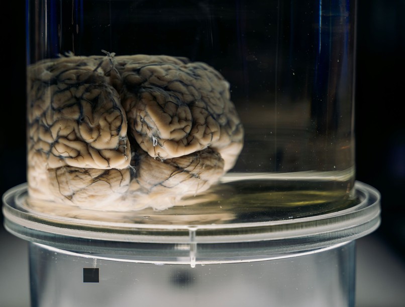 Einstein agy vizsgál kutatás