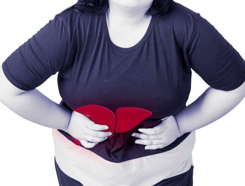 Emelkedett LDH szint zsírmáj