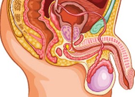 Priapizmus: tünetei, vizsgálata és kezelése