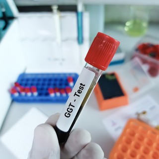 Mit jelent a GGT érték a laborleleten? című cikk nyitóképe