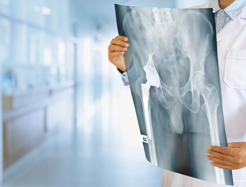 Combnyaktörés tünet vizsgálat kezelés