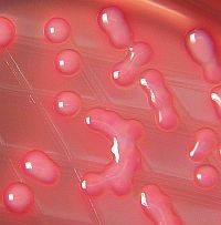 Az egész világot fenyegetik az antibiotikumoknak ellenálló baktériumok