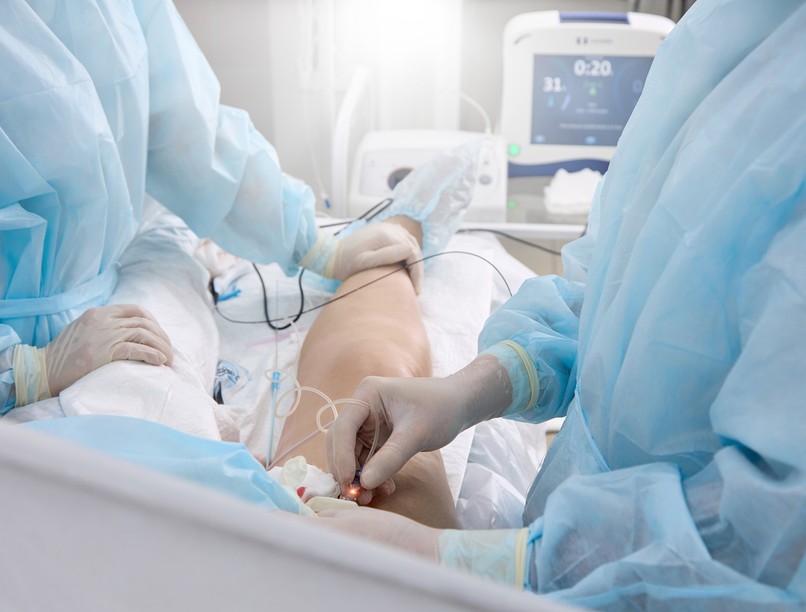 ablációs kezelés rádiófrekvenciás abláció leírás