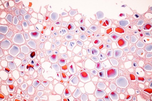 Ez az a folyamat, amely a nap minden pillanatában milliónyiszor lezajlik a szervezetében