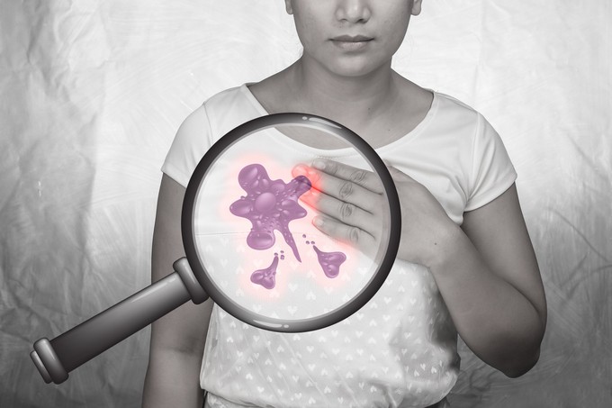 Mellrák és gombák: lehet, hogy a gombák lesznek az új szövetségeseink című cikk nyitóképe