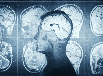 4 mindennapi szokás, amely észrevétlenül felgyorsíthatja az agy öregedését című cikk nyitóképe