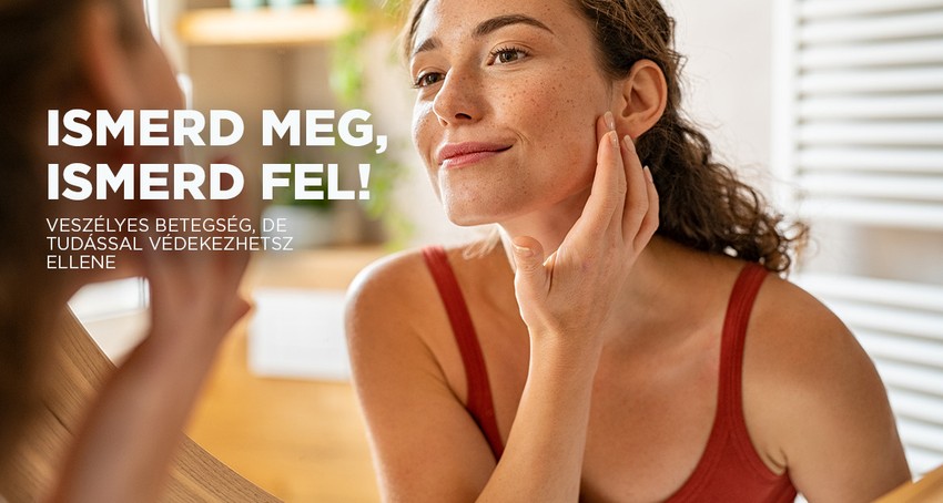 Melanoma: így ismerjük fel a bőrrák jeleit