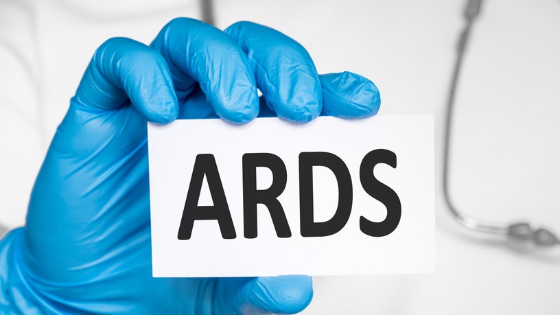 Akut légúti distressz szindróma ARDS