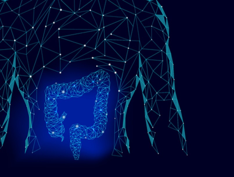 bélrendszeri daganatok, vastagbél, korai, diagnózis, rák, tumor