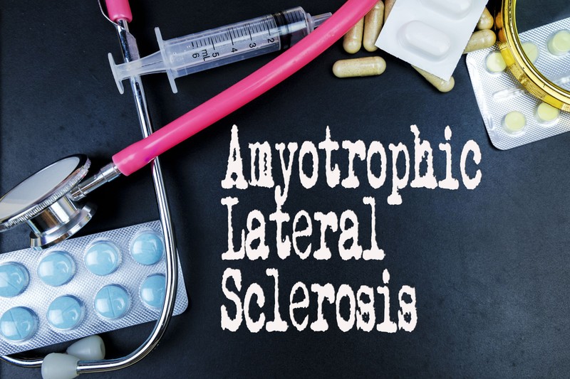 Az ALS okai, tünetei és kezelési lehetőségei