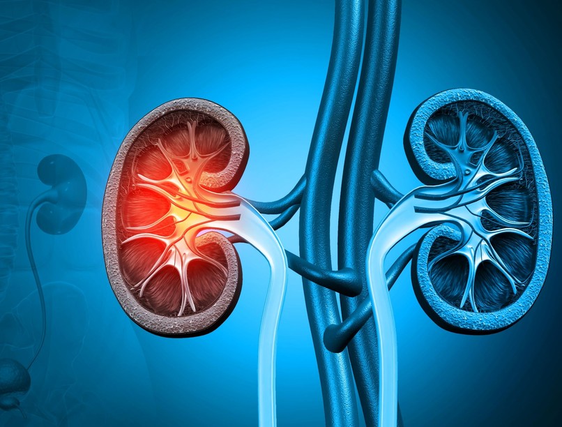 krónikus vesebetegség veseelégtelenség dialízis