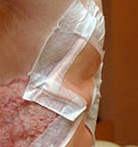 Húsevő baktérium okozta fertőzés (szöveti nekrózis)