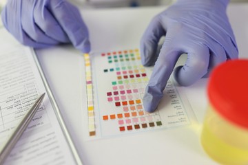 A hőség a veséket is ostromolja - ha ilyen színű a vizelete, már dehidratált, sürgősen igyon vizet!