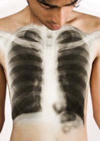 A tbc-ellenes világnap margójára