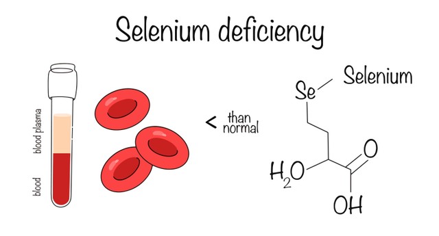 Szelénhiány tünetei, vizsgálata és kezelési lehetőségei
