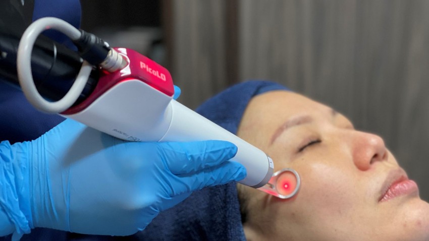 Mik azok a pigmentfoltok és hogyan szabadulhatunk meg tőlük még nyár előtt?