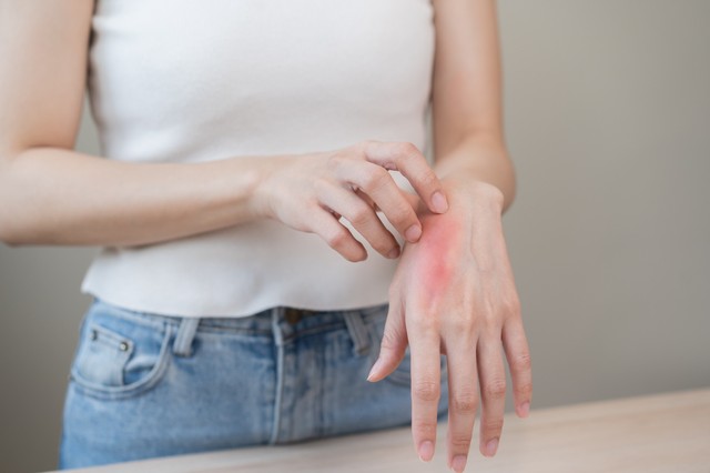 Allergiás vagyok a kontrasztanyagra, hogy menjek így MR-re? Az orvos válaszol