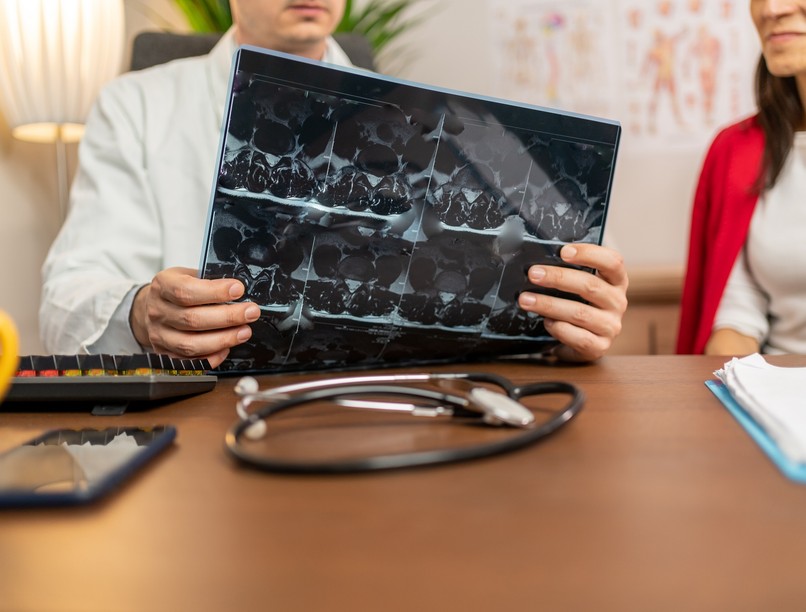 szklerózis multiplex végső stádiuma