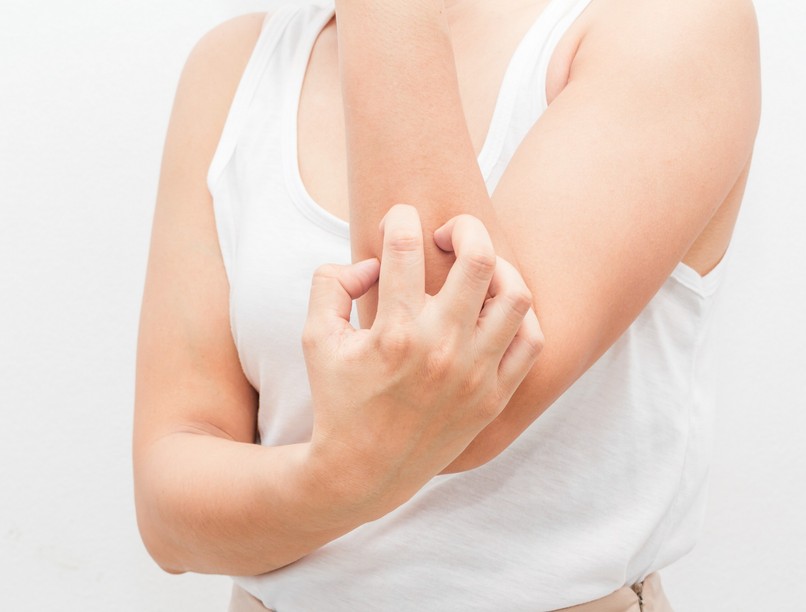 májgyulladás, tünetei, viszketés kiütés