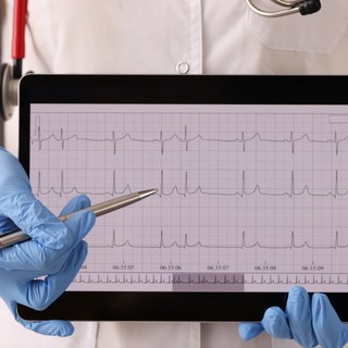 Szívritmuszavar: így ismerhető fel a tünetek alapján című cikk nyitóképe