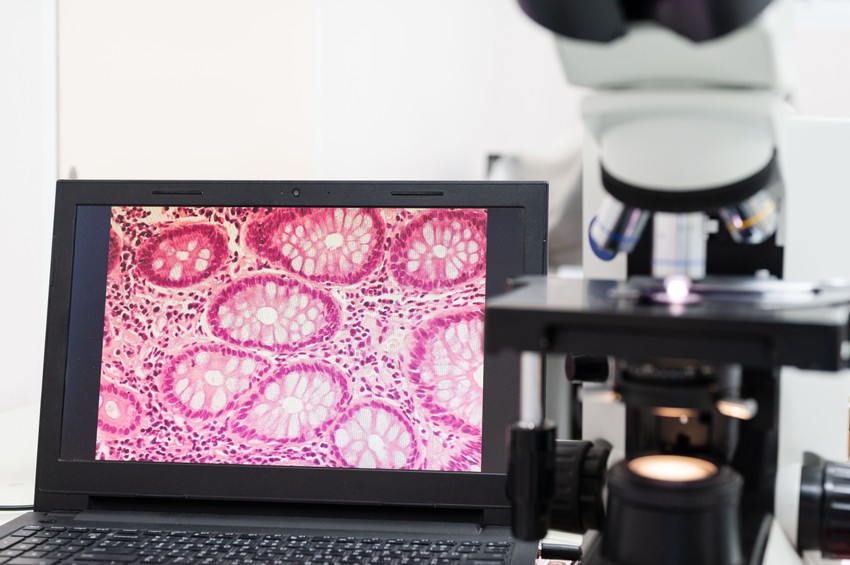 Ezek alapján állapítják meg, hogy a daganatos betegség milyen stádiumban van. A daganat stádiumbesorolásának jelentősége, hogy általa osztályozzák a tumort, meghatározva a betegség jellemzőit, előrehaladottságának mértékét, ezzel közvetve kijelölve a betegnél szóba jöhető terápiás lehetőségeket.