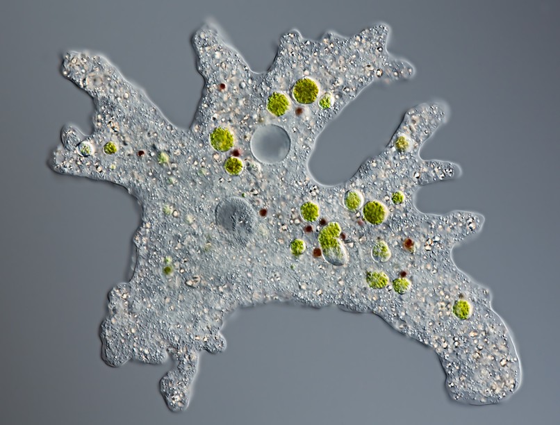 amőba, agyevő, fertőzés, halál