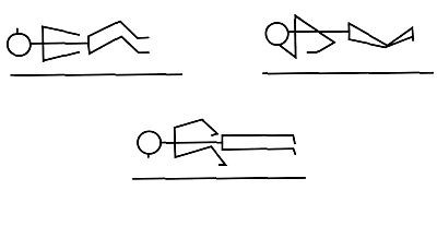 Stroke: a betegápolás speciális szempontjai: mozgatás, önálló mozgások