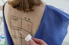 Évről évre hosszabb a szenvedés: kiderült, miért durvul be egyre jobban a pollenszezon (x) című cikk nyitóképe