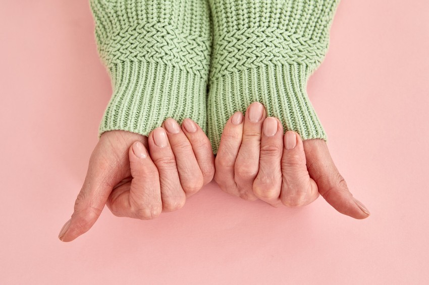 A vashiányra nem mindig a fáradtság és a sápadt bőr hívja fel a figyelmet.