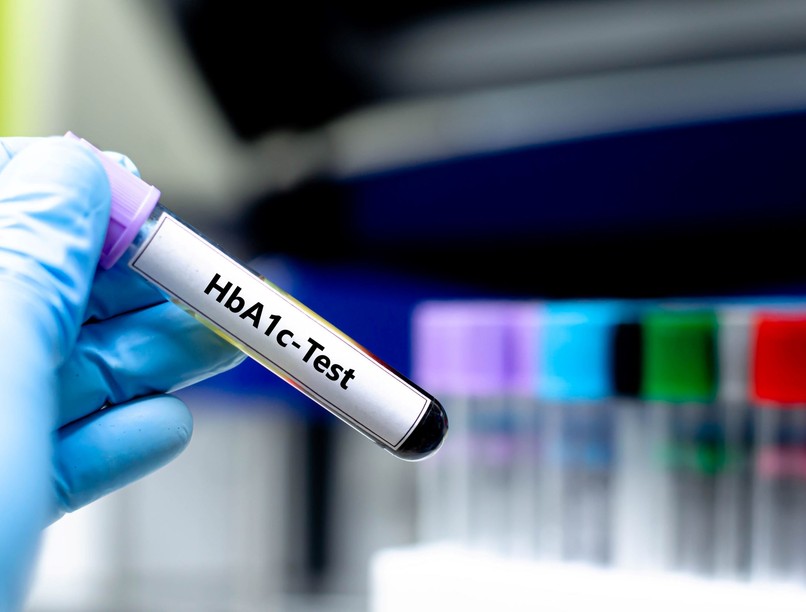 HbA1c cukorbetegség ellenőrzés beállítás