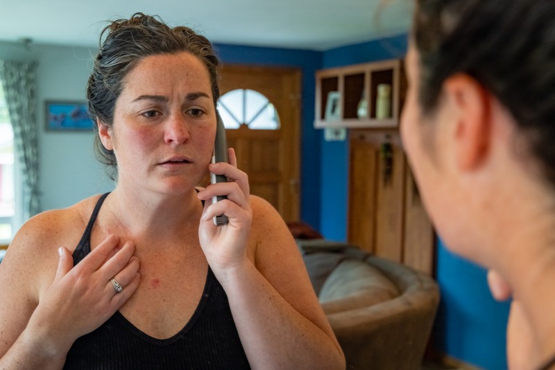 Bőr alatti csomó, dudor: így néz ki a laphámrák és a basalioma