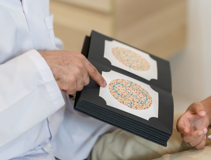 színlátás, szem, teszt, színtévesztés