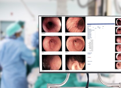 Normális esetben ilyen vékonyka a vastagbél fala - mire utal az, ha már megvastagodott? című cikk nyitóképe