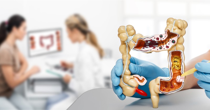 Őssejtekkel segítik a Crohn-betegek gyógyulását a Semmelweis Egyetemen