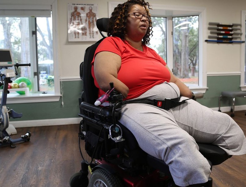 kez, láb, műtét, amputálás