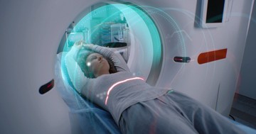 Mi a különbség az MR és az MRI vizsgálat között?