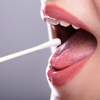 Mire utal a nyálfolyás? című cikk nyitóképe