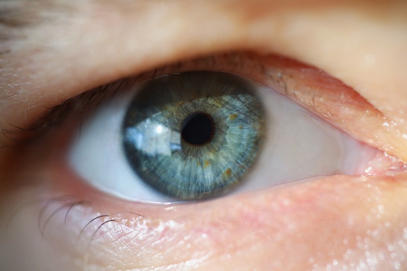 Myasthenia gravis: a szemén veheti észre az életveszélyes betegség az első jeleit
