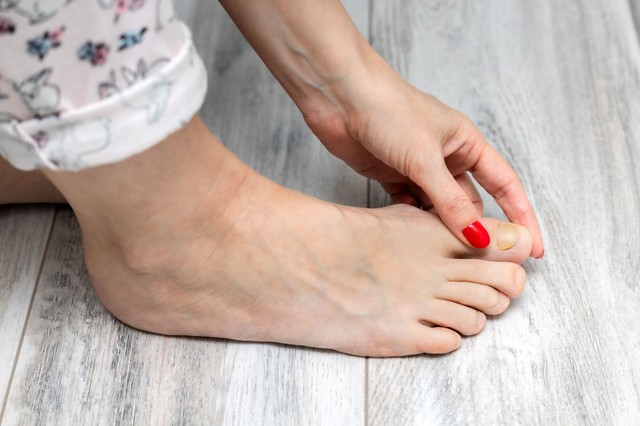 Hatékony és természetes módszerek a körömgomba kezelésére