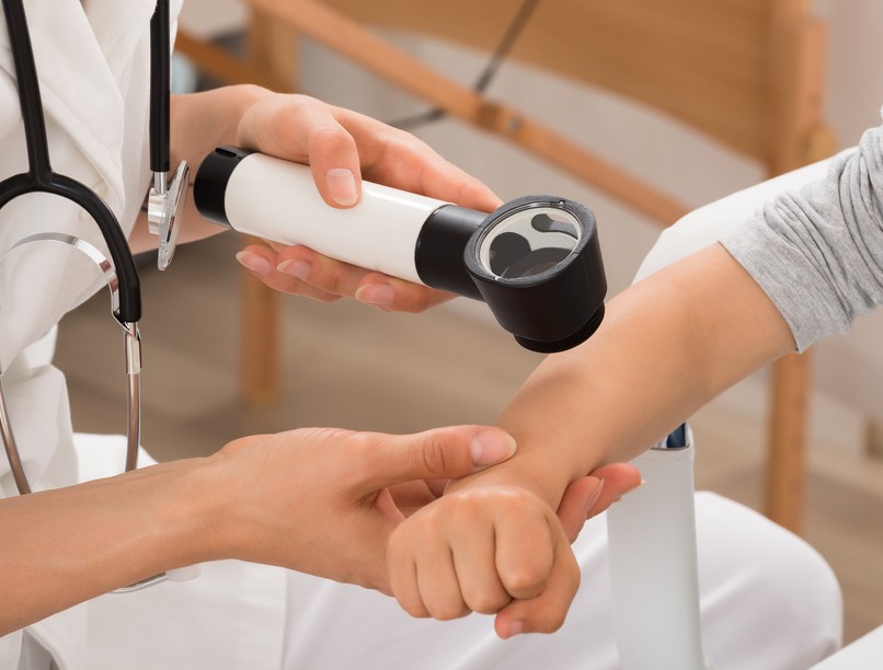 melanoma, basalioma, rákszures, rák, bőrrák