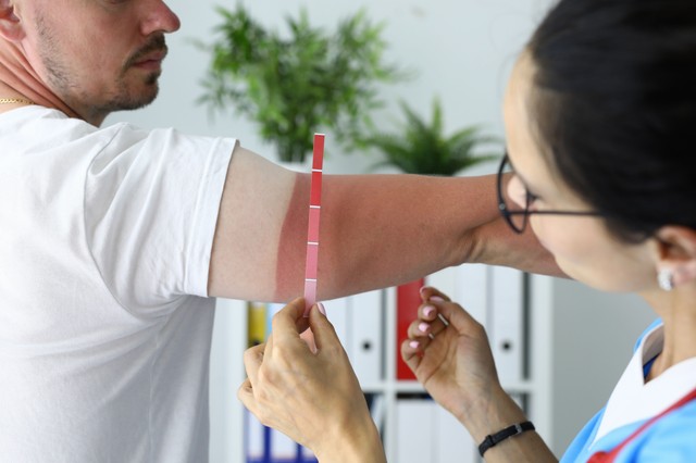 6 tanács a bőrgyógyásztól - így védekezzen a nap káros sugarai ellen