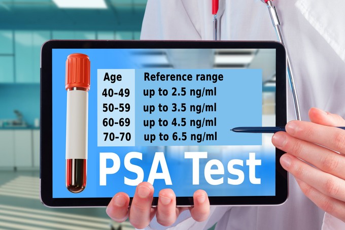 Mi a normális PSA-szint életkor szerint? Ezt jelzik a csillagos eltérések a leleten című cikk nyitóképe