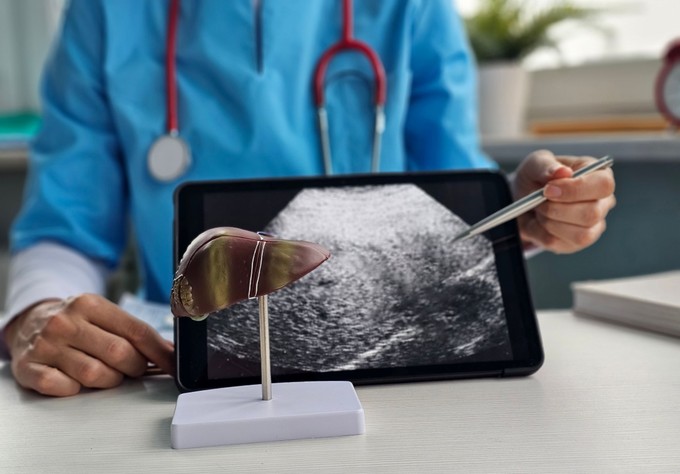 Hogyan gyógyítható a májrák? A modern onkológia valódi lehetőségei és korlátai  című cikk nyitóképe