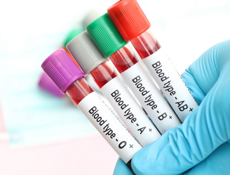 stroke agyvérzés kialakulása vércsoport alapján