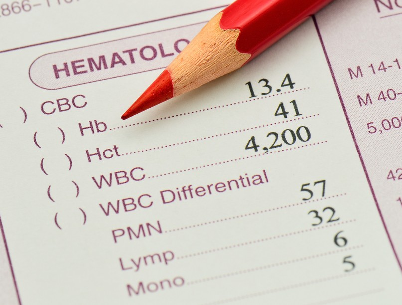 Mit jelent a Hematokrit Htc érték a laborleleten