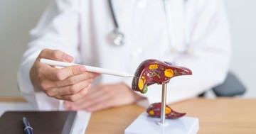 Hogyan gyógyítható a zsírmáj? Ezeket a tanácsokat érdemes betartania